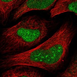 TSPYL1 Antibody, Novus Biologicals 0.1mL; Unlabeled:Antibodies, Polyclonal